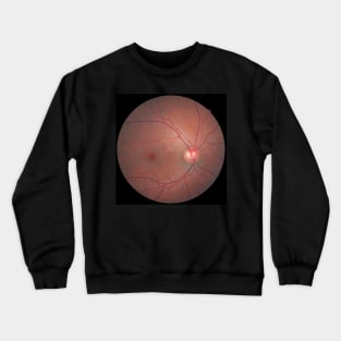 Eyebal X-ray Crewneck Sweatshirt